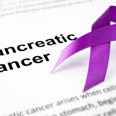 The Pancreatic Cancer Collective Funds Two New Research Teams Using Artificial Intelligence To Identify High-Risk Pancreatic Cancer Populations