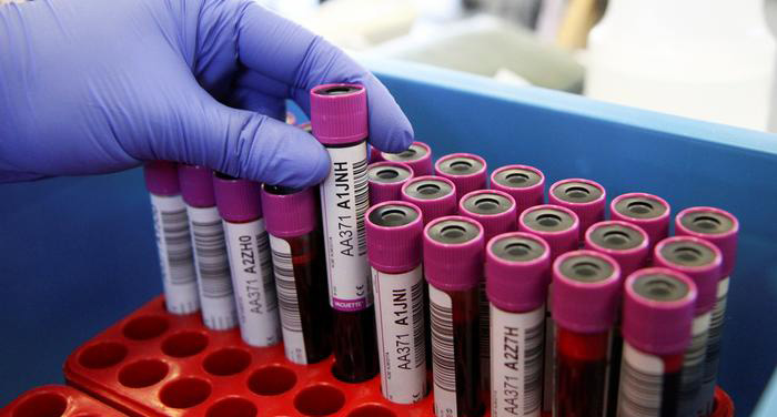 Nearly One-Quarter of the Nation's Blood Supply is Needed for Cancer ...