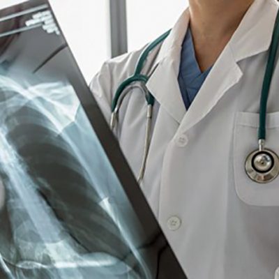 Concerning Delays in TB Diagnoses in the United States