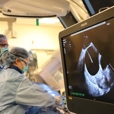 Northwestern Medicine First in United States to Use Live 3D Intracardiac Echo for Heart Rhythm Procedure