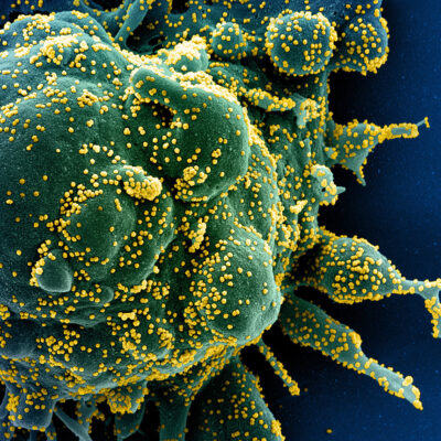 Study Shows Breakthrough Infections Boost Immune Response Against SARS-CoV-2 Variants