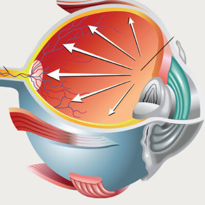 New Hope for Ophthalmic Health