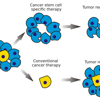 Rethinking Radiation Therapy: Uncovering New Strategies to Defeat Cancer