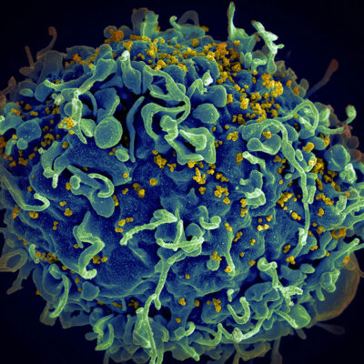 Portable HIV Monitoring Device Shows Promise for Remote Settings